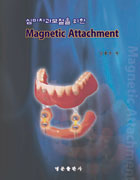 심미치과 보철을 위한 Magnetic Attachment