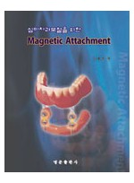 심미치과 보철을 위한 Magnetic Attachment