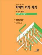 치아의 이식 · 재식 - 치유의 병리 - 치근막을 살린다 -