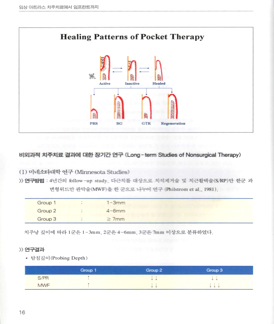 치주치료에서 임프란트까지 - 1 치주치료