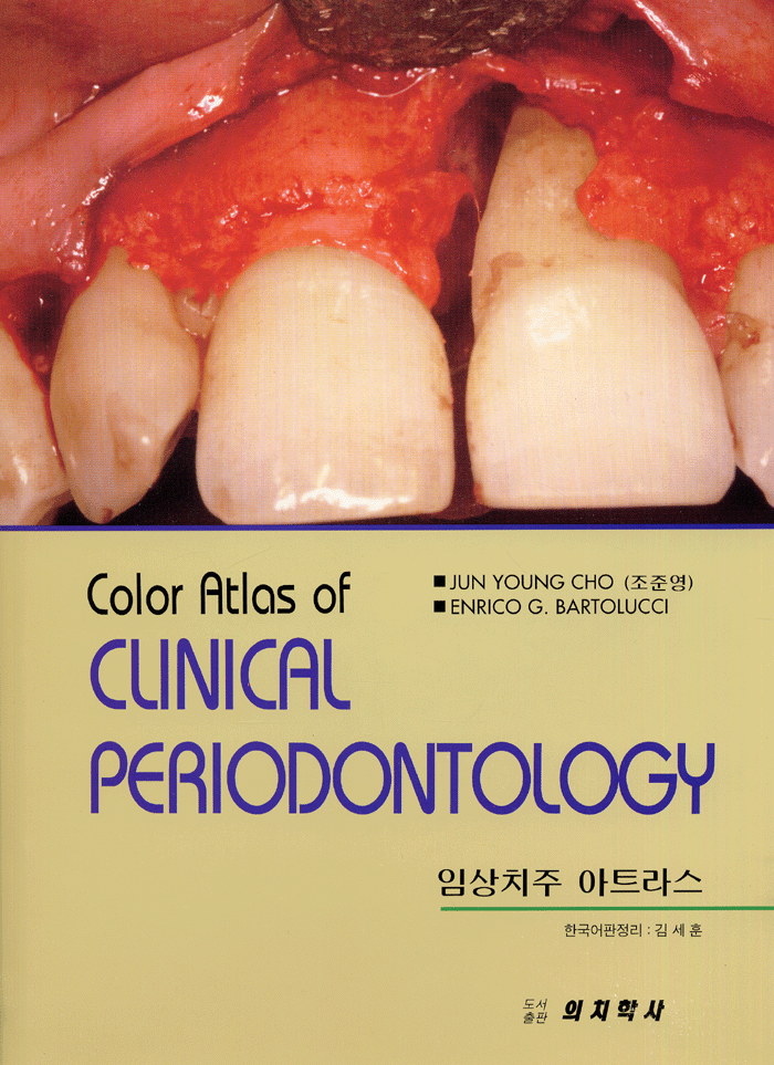 임상치주 아트라스(Color Atlas of CLINICAL PERIODONTOLOGY)