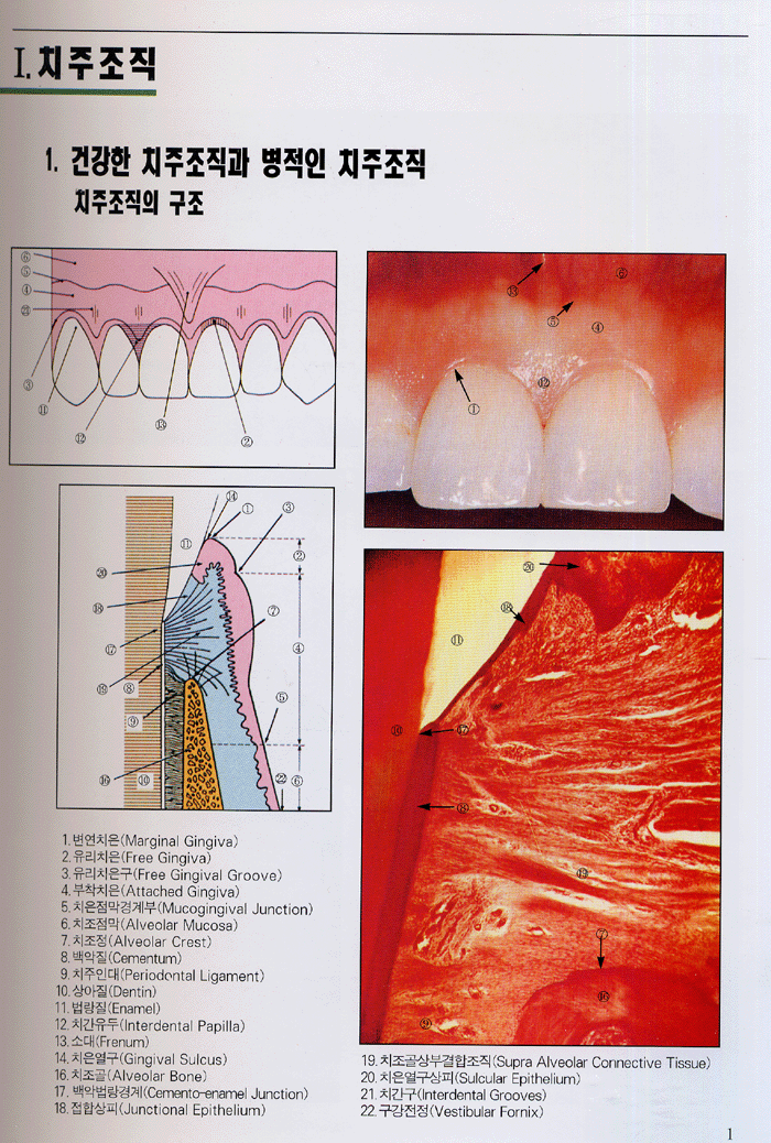 임상치주 아트라스(Color Atlas of CLINICAL PERIODONTOLOGY)