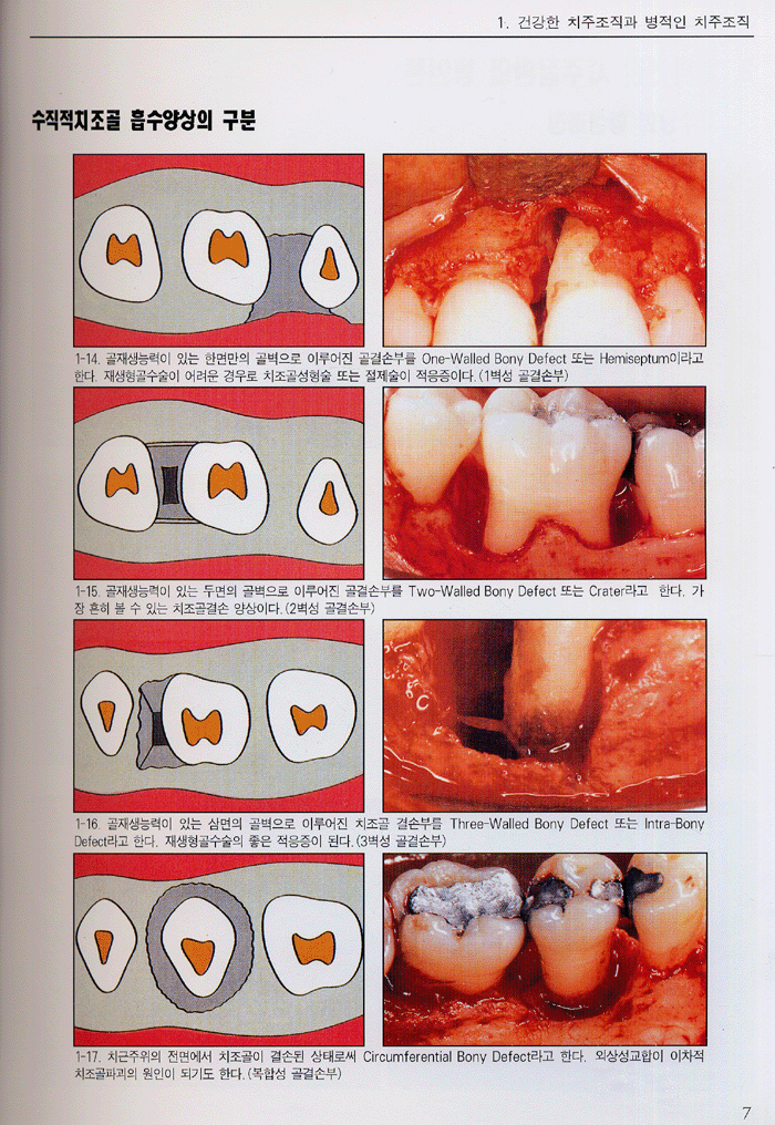 임상치주 아트라스(Color Atlas of CLINICAL PERIODONTOLOGY)