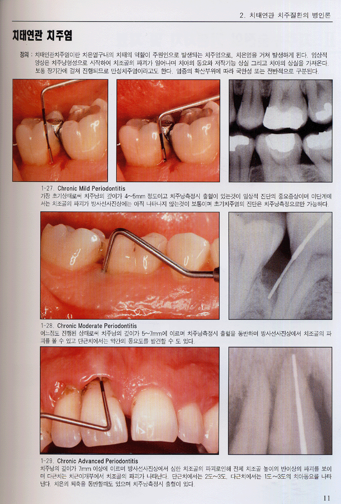 임상치주 아트라스(Color Atlas of CLINICAL PERIODONTOLOGY)