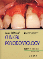 임상치주 아트라스(Color Atlas of CLINICAL PERIODONTOLOGY)