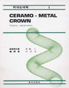 치과도재학(1)-CERAMO-METAL CROWN