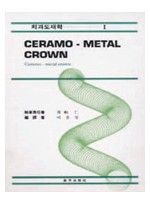 치과도재학(1)-CERAMO-METAL CROWN