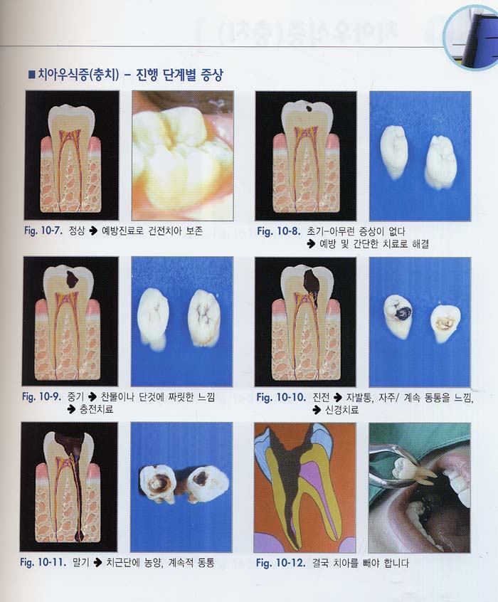 구강의 이해