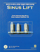 SINUS LIFT - 체계적으로 배우는 상악동 거상술의 이해와 임상적용 -