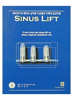 SINUS LIFT - 체계적으로 배우는 상악동 거상술의 이해와 임상적용 -