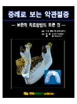 증례로 보는 악관절증-보존적 치료방법의 모든것