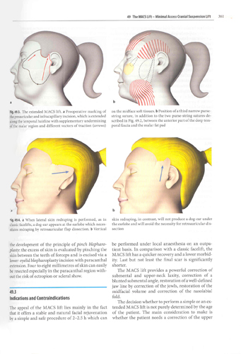 Aesthetic Surgery of the Facial Mosaic (with DVD)