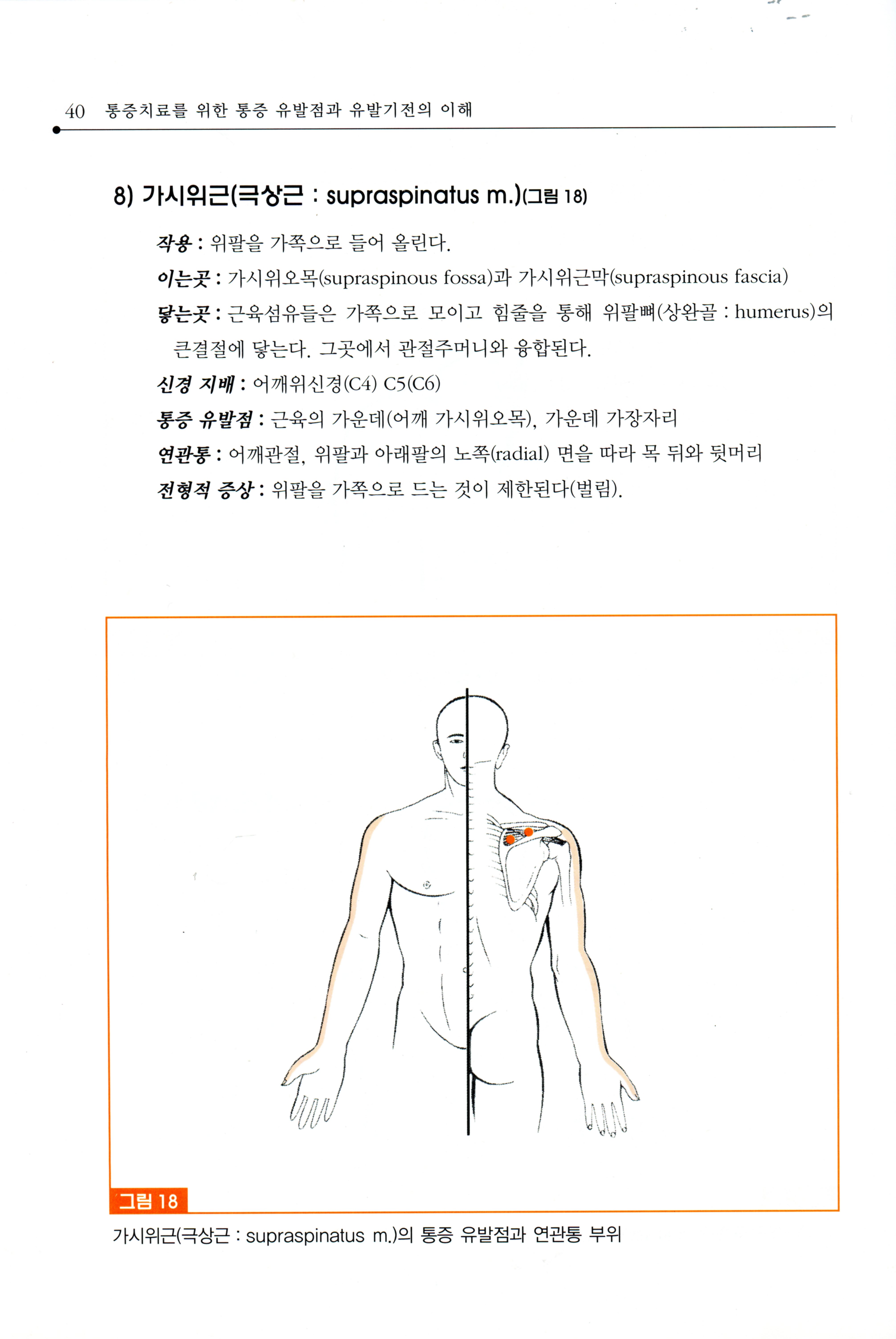 통증치료를 위한 통증유발점과 유발기전의 이해