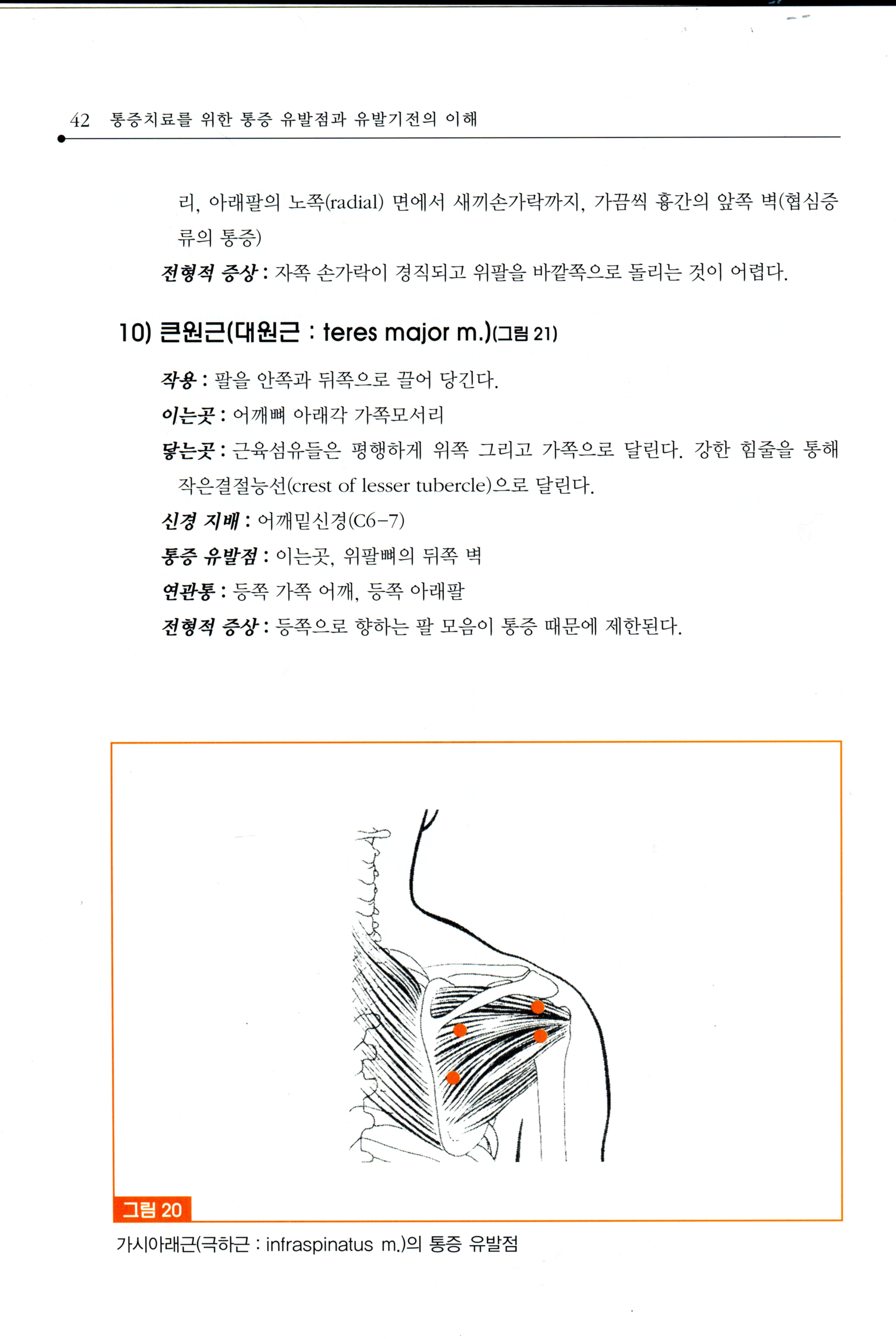 통증치료를 위한 통증유발점과 유발기전의 이해