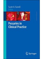 Pessaries in Clinical Practice