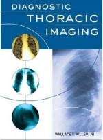 Diagnostic Thoracic Imaging 1/e