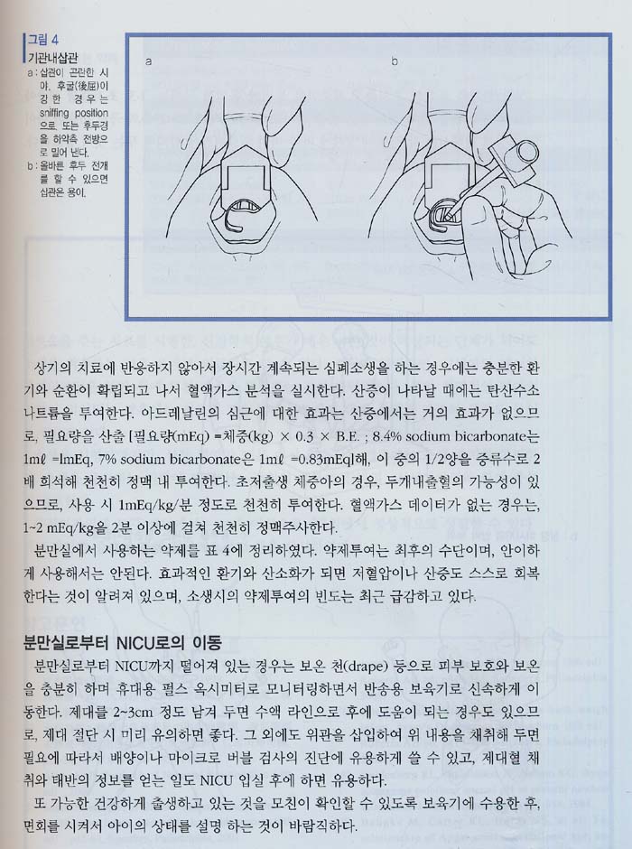 초미숙아 : 초저출생 체중아의 관리 지침