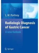 Radiologic Diagnosis of Gastric Cancer