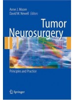 Tumor Neurosurgery:Principles & Practice