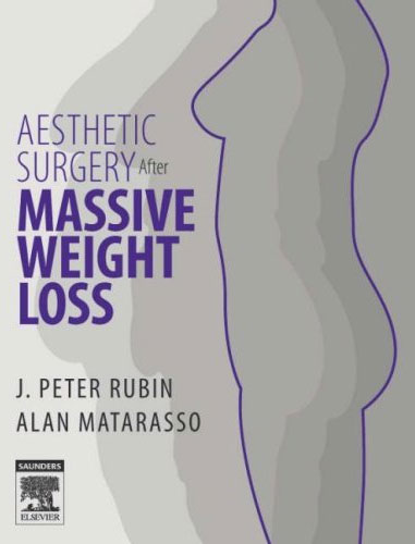 Aesthetic Surgery After Massive Weight Loss