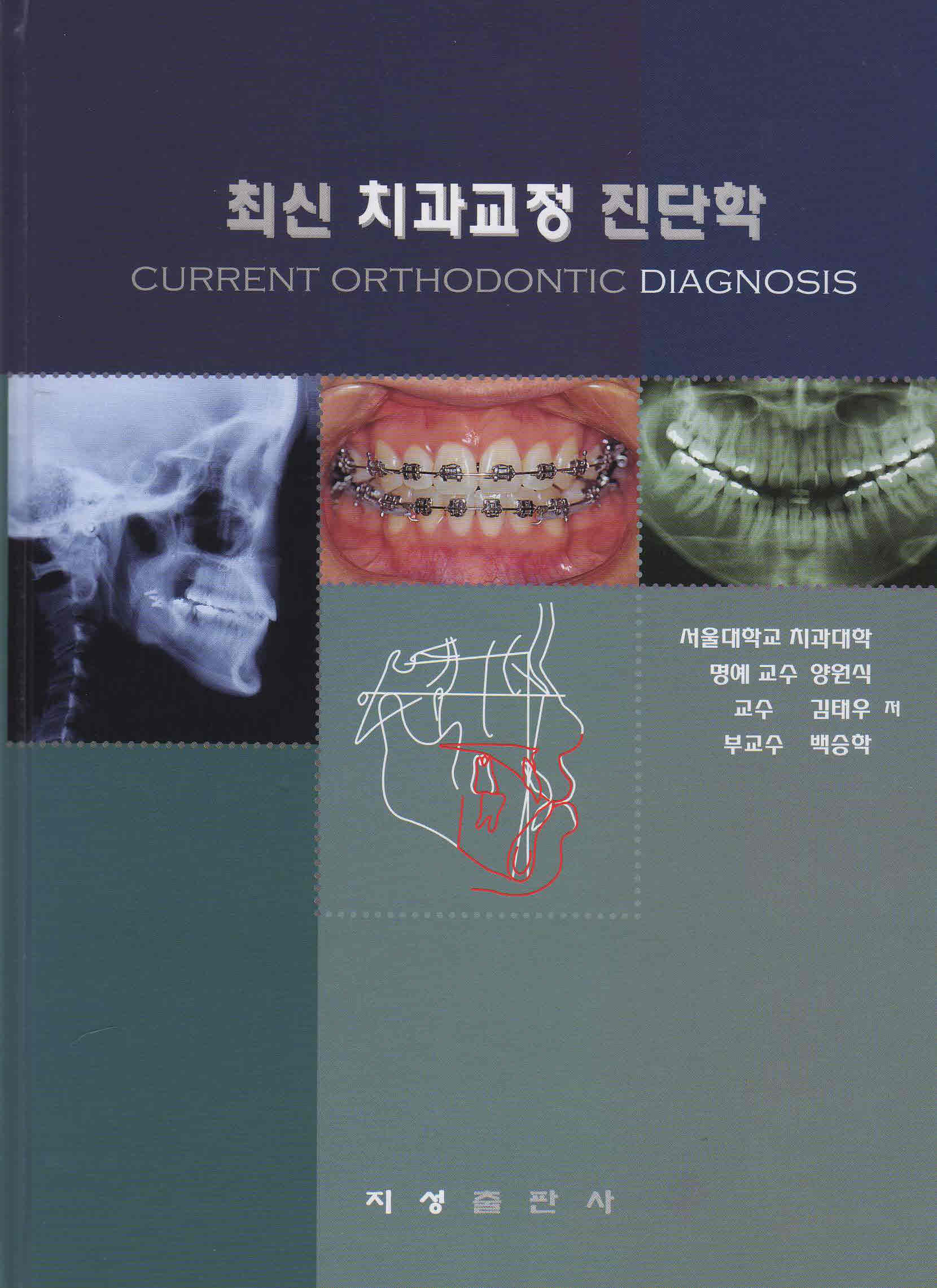 최신 치과교정 진단학 - Current Orthodontic Diagnosis -