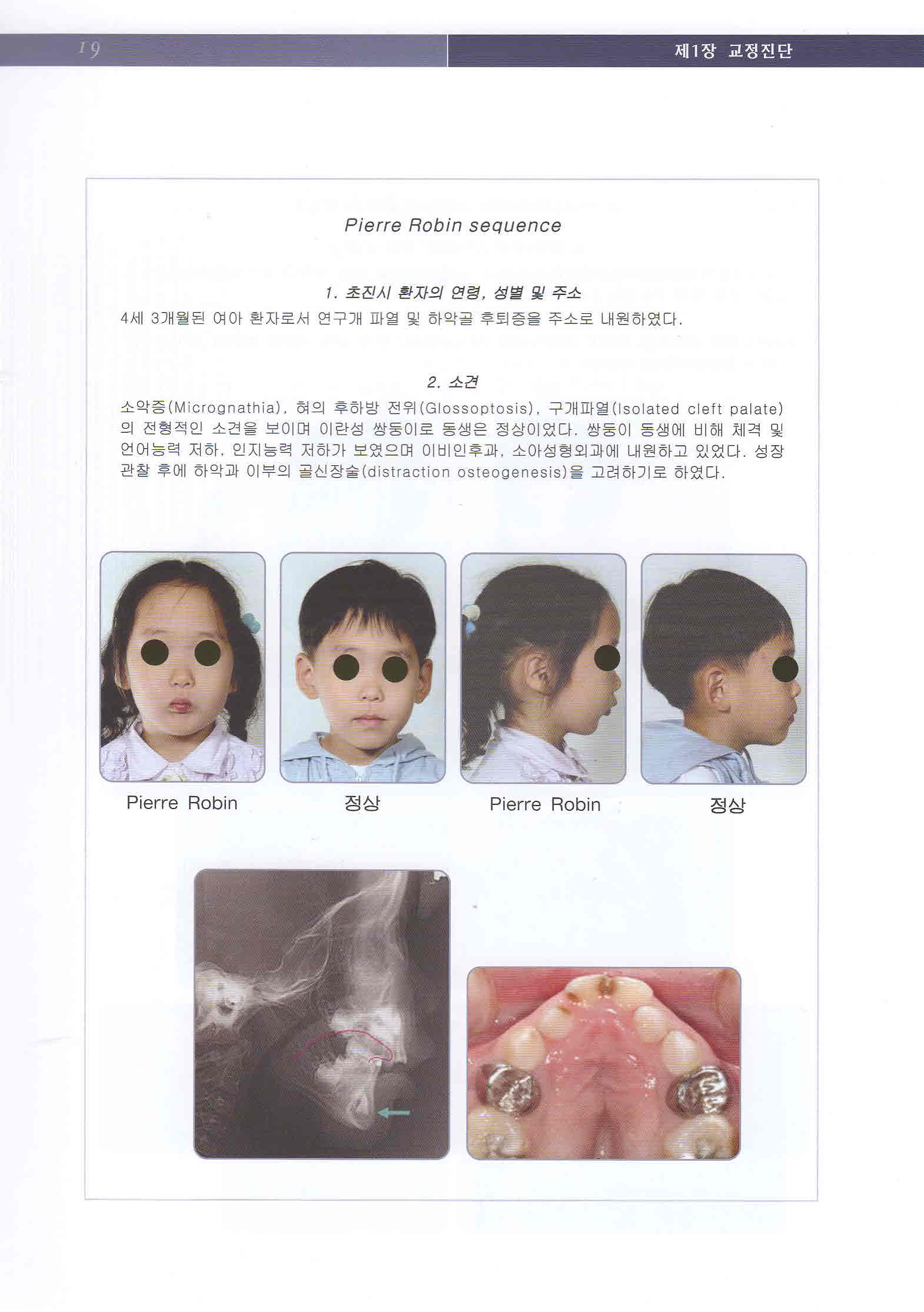 최신 치과교정 진단학 - Current Orthodontic Diagnosis -