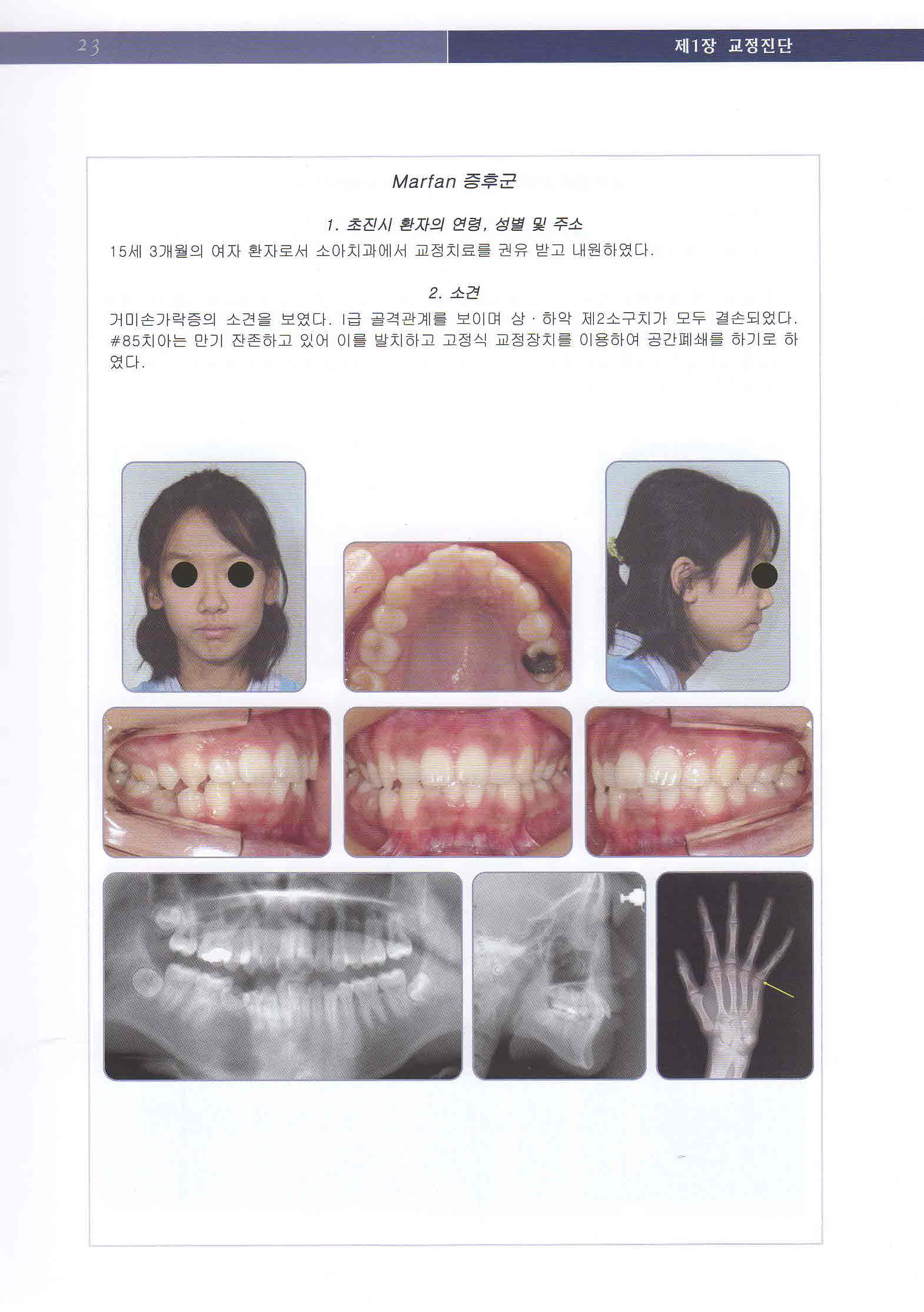 최신 치과교정 진단학 - Current Orthodontic Diagnosis -