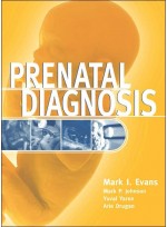 Prenatal Diagnosis