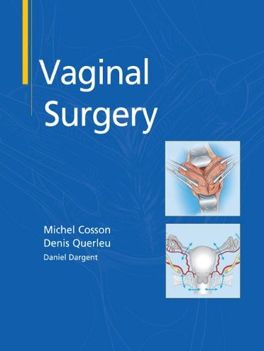 Vaginal Surgery