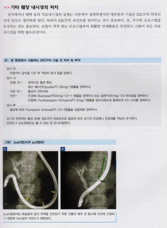 췌 담도 치료내시경의 실제