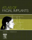 Atlas of Facial Implants ,1/e