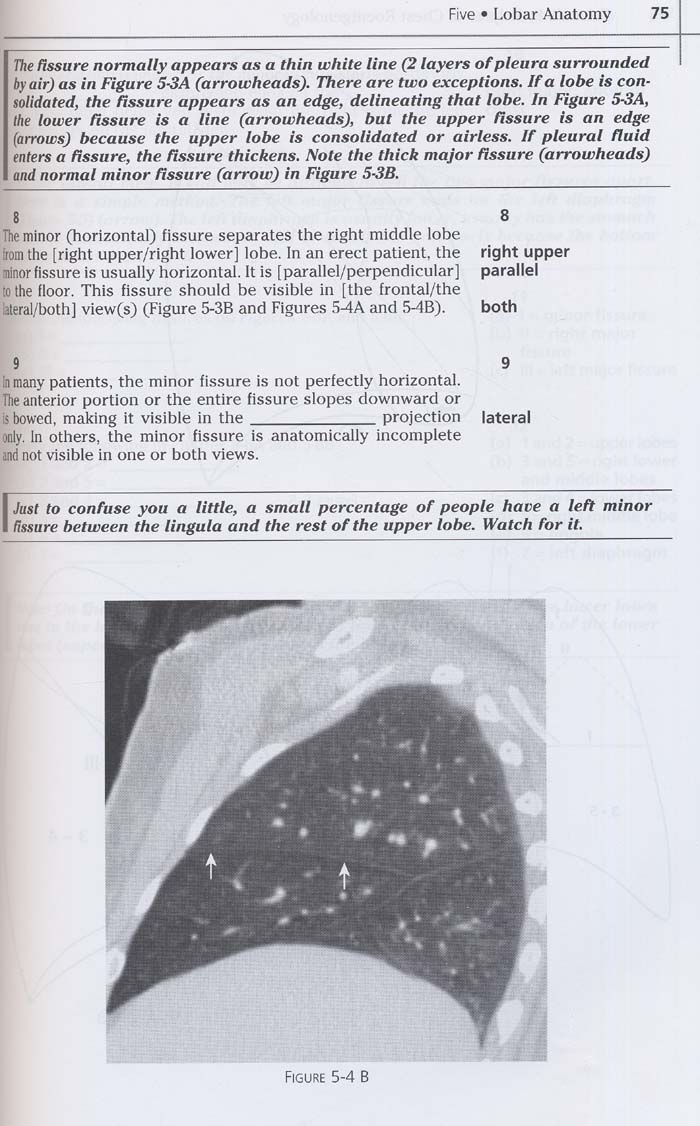 Felson's Principles of Chest Roentgenology Text with CD-ROM,3/e