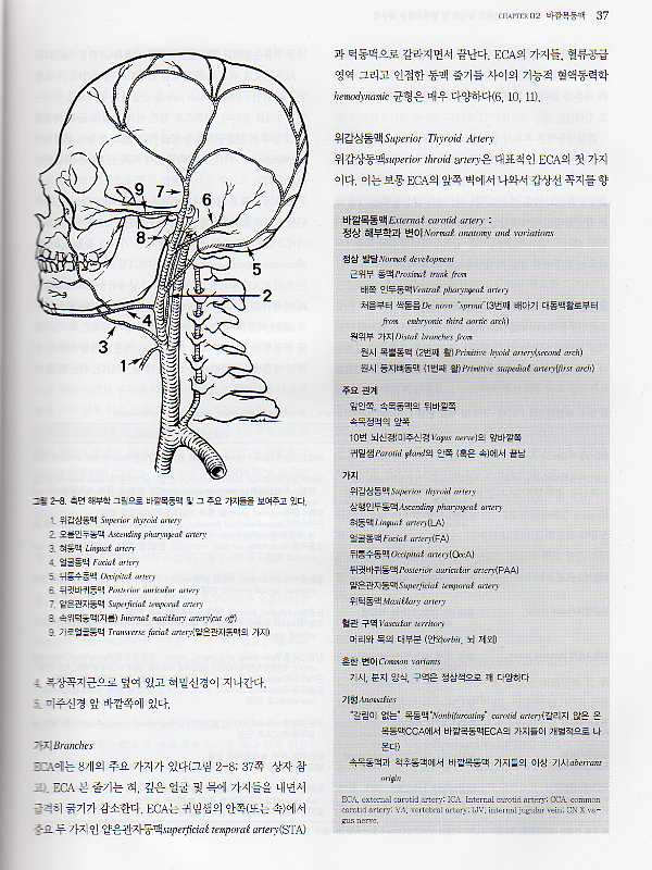 오스본 뇌혈관조형술(Diagnostic Cerebral Angiography)