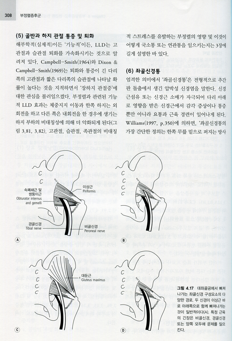 부정렬증후군 제2판