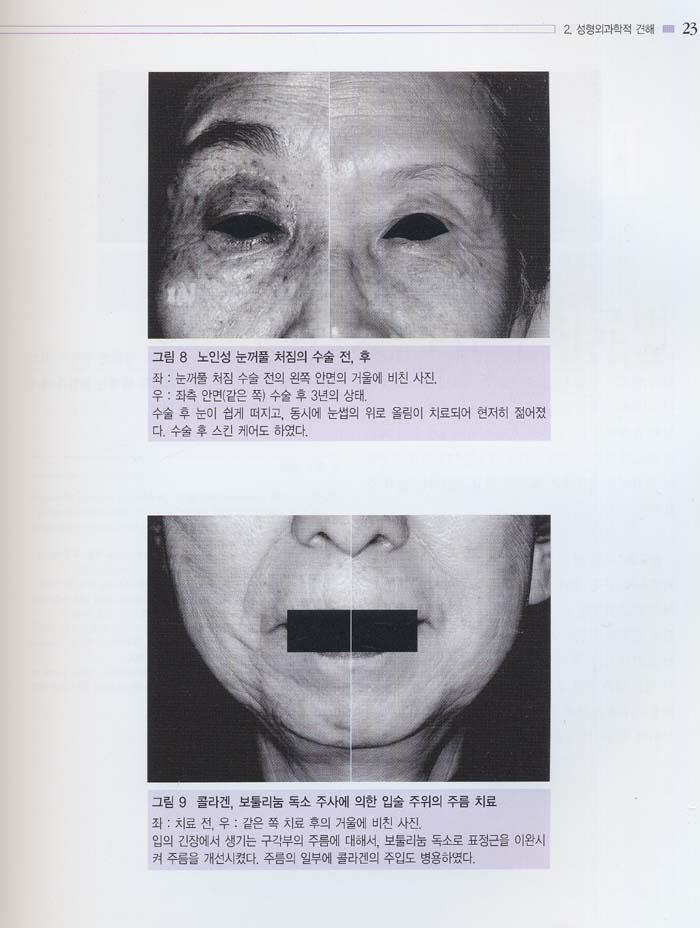 안면 노화방지 로드맵 (Facial Rejuvenation Treatment) Vol.2