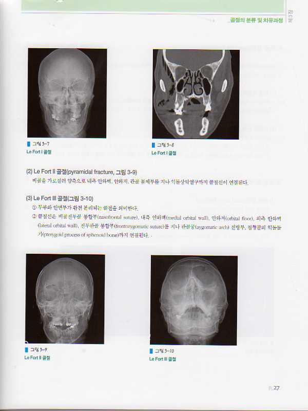 악안면외상학