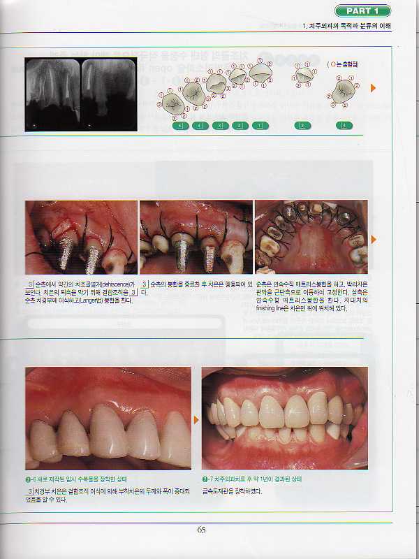 그림으로 배우는 외과적 치주치료