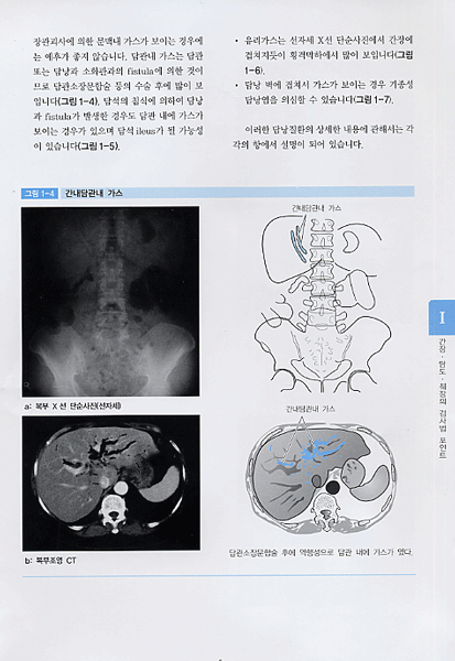 복부 영상 판독법 - 쉽게 이해하는-