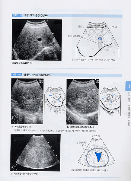 복부 영상 판독법 - 쉽게 이해하는-