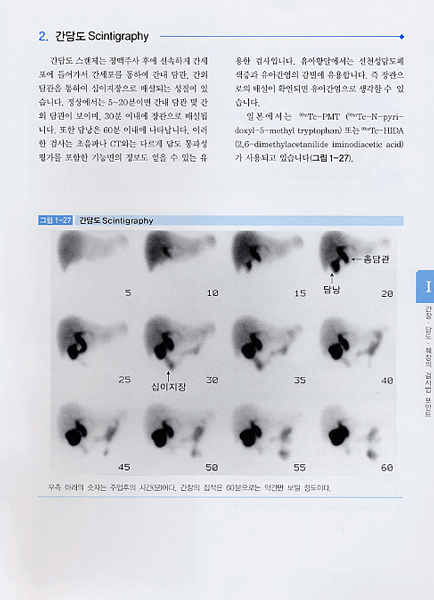 복부 영상 판독법 - 쉽게 이해하는-