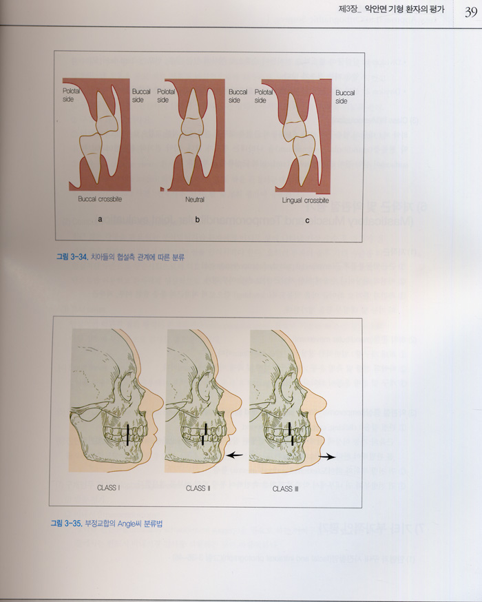 쉽게 접근하는 악교정수술