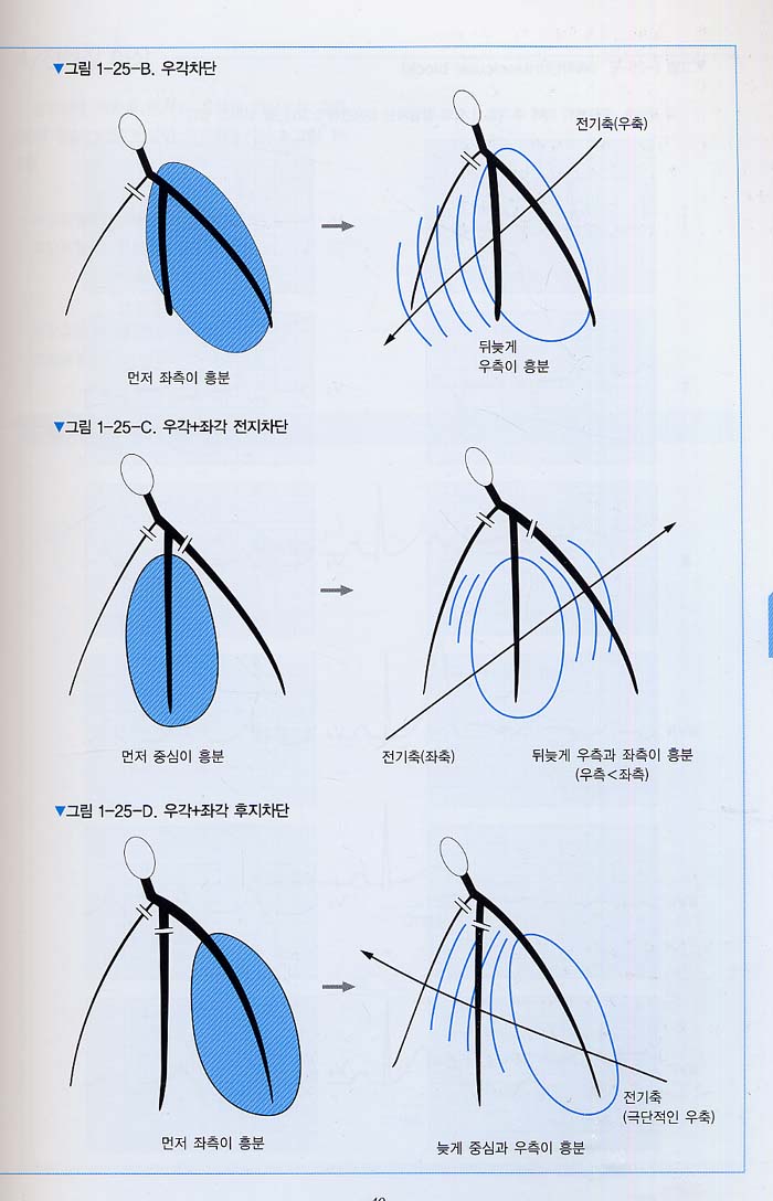 심장초음파,심전도 판독법 - 쉽게 이해하는