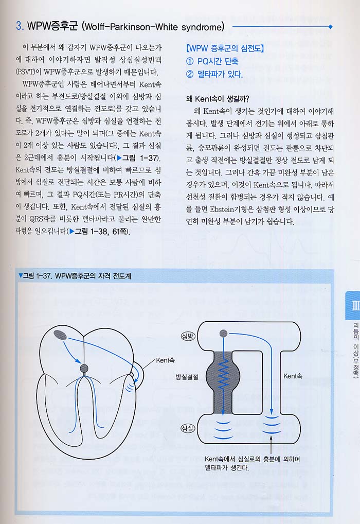 심장초음파,심전도 판독법 - 쉽게 이해하는