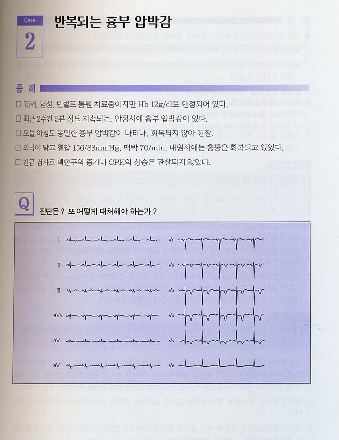 ECG 케이스 파일 - 심장병진료에대한 Sense를 몸에익히다