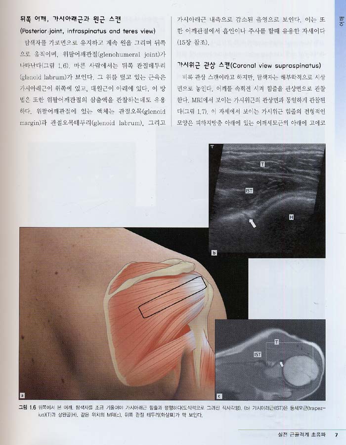 실전근골격계초음파 Practical Musculoskeletal Ultrasound