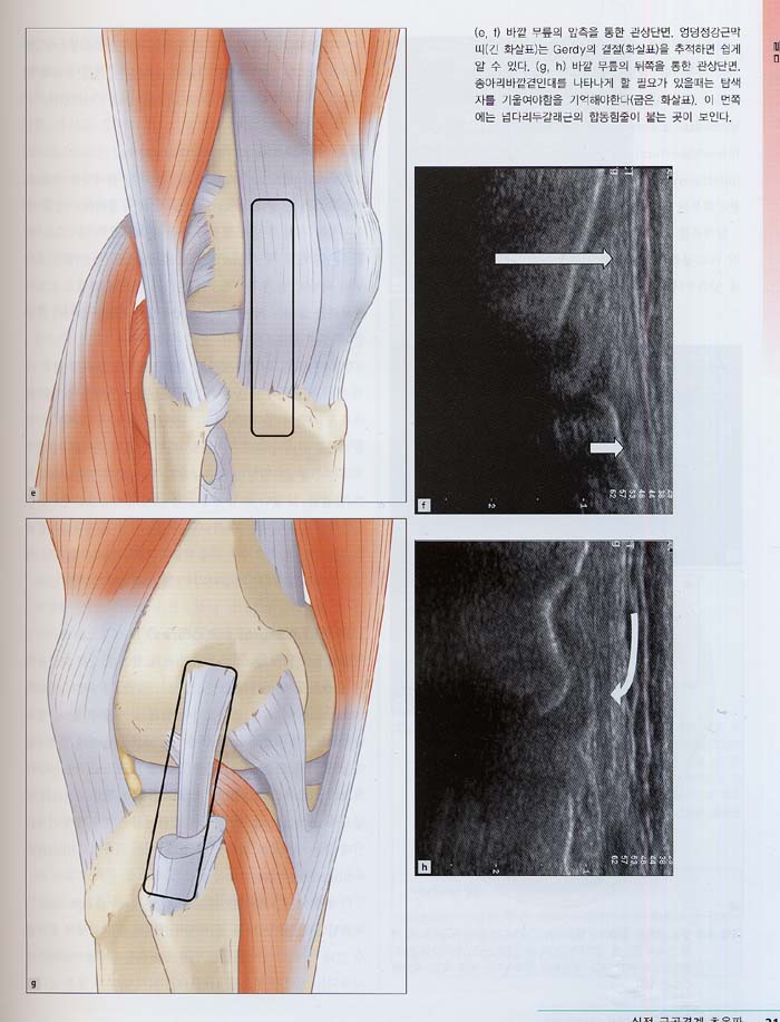 실전근골격계초음파 Practical Musculoskeletal Ultrasound