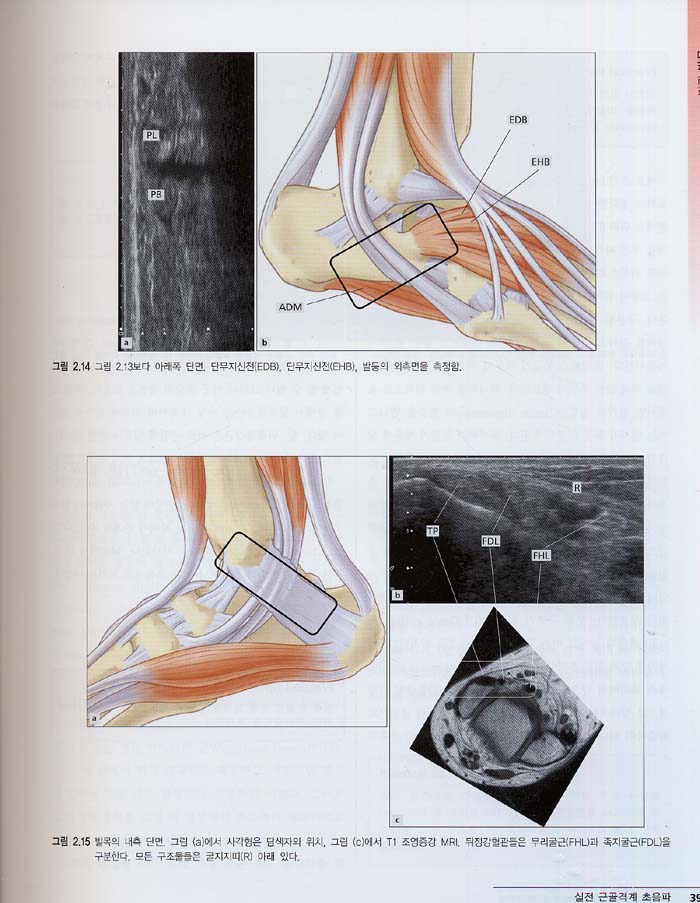 실전근골격계초음파 Practical Musculoskeletal Ultrasound