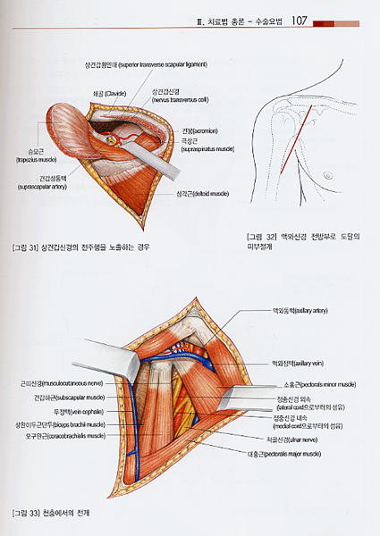 그림으로 보는 임상견관절학