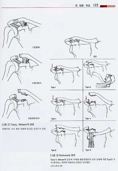 그림으로 보는 임상견관절학