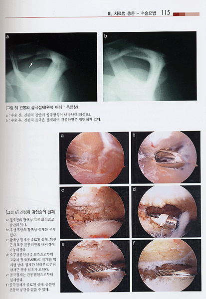 그림으로 보는 임상견관절학